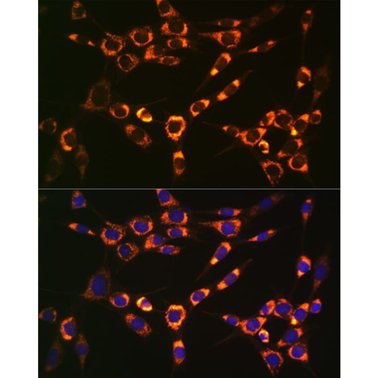 Immunofluorescence - Anti-PBR Antibody [ARC0308] (A305742) - Antibodies.com