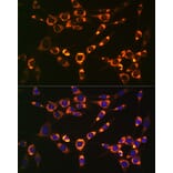 Immunofluorescence - Anti-PBR Antibody [ARC0308] (A305742) - Antibodies.com