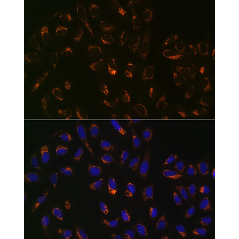 Immunofluorescence - Anti-PBR Antibody [ARC0308] (A305742) - Antibodies.com