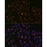 Immunofluorescence - Anti-PBR Antibody [ARC0308] (A305742) - Antibodies.com
