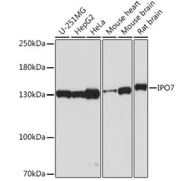 Western Blot - Anti-Importin 7 Antibody (A305743) - Antibodies.com