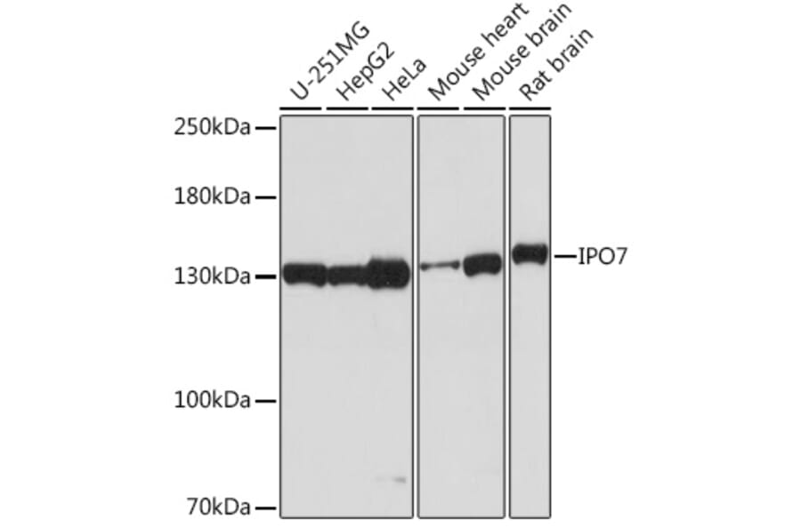 Western Blot - Anti-Importin 7 Antibody (A305743) - Antibodies.com