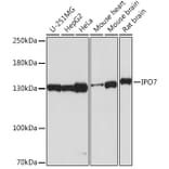Western Blot - Anti-Importin 7 Antibody (A305743) - Antibodies.com