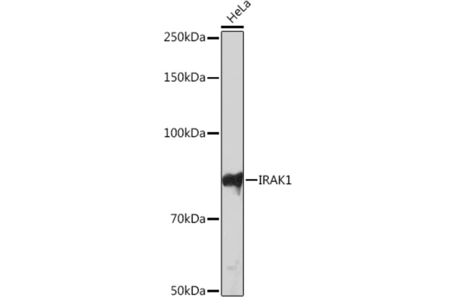 Western Blot - Anti-IRAK-1 Antibody [ARC1009] (A305745) - Antibodies.com