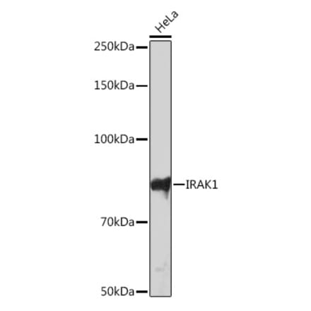 Western Blot - Anti-IRAK-1 Antibody [ARC1009] (A305745) - Antibodies.com