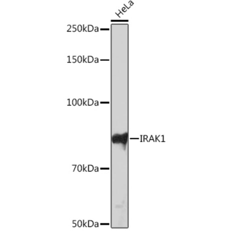 Western Blot - Anti-IRAK-1 Antibody [ARC1009] (A305745) - Antibodies.com