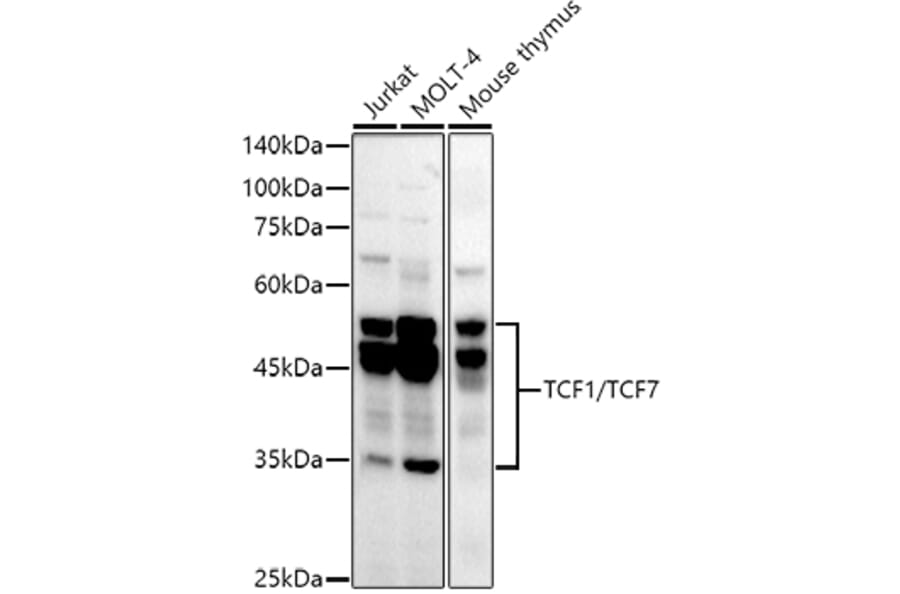 Western Blot - Anti-TCF7 Antibody [ARC51870] (A305746) - Antibodies.com