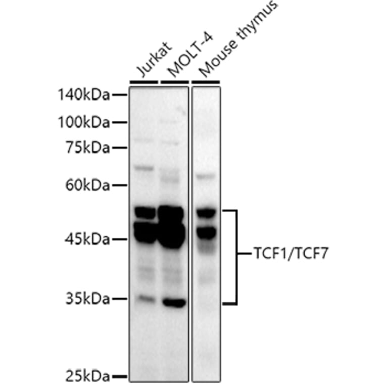 Western Blot - Anti-TCF7 Antibody [ARC51870] (A305746) - Antibodies.com