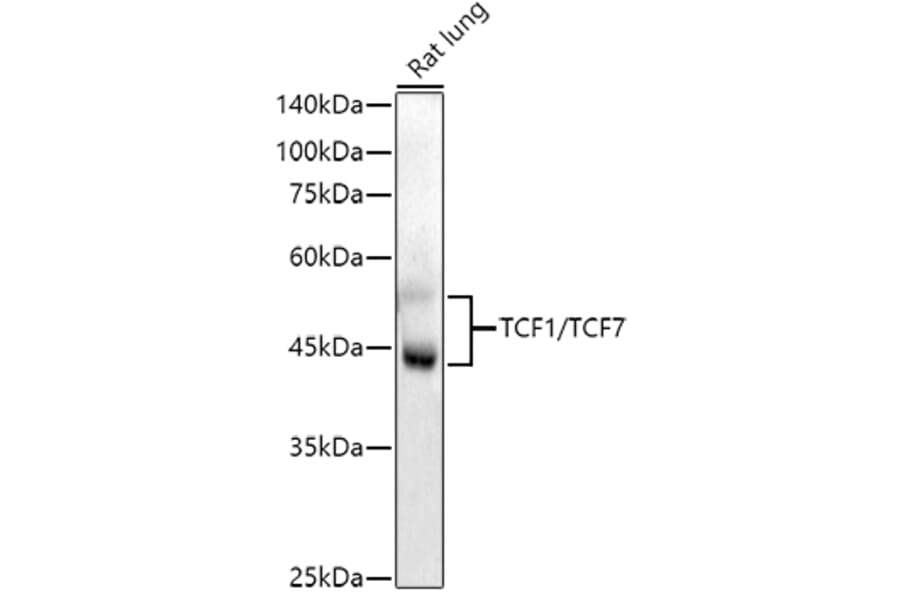 Western Blot - Anti-TCF7 Antibody [ARC51870] (A305746) - Antibodies.com