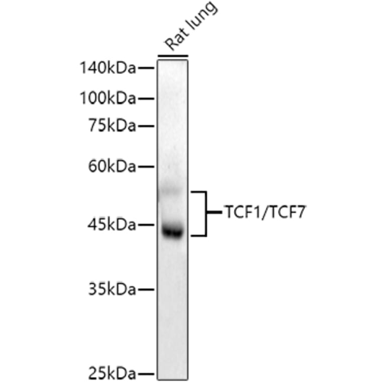 Western Blot - Anti-TCF7 Antibody [ARC51870] (A305746) - Antibodies.com