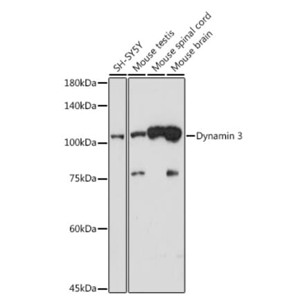 Western Blot - Anti-Dynamin 3 Antibody [ARC2428] (A305747) - Antibodies.com