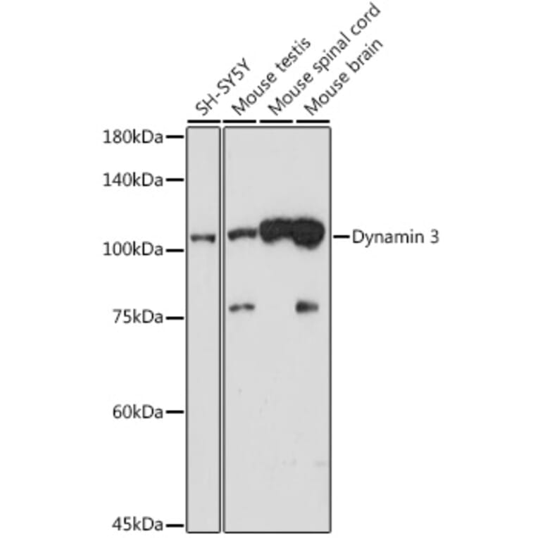 Western Blot - Anti-Dynamin 3 Antibody [ARC2428] (A305747) - Antibodies.com