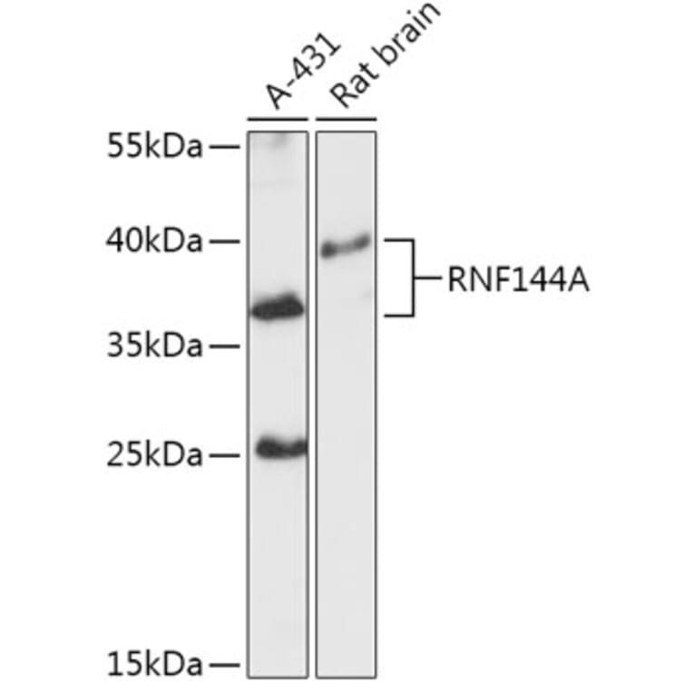 Western Blot - Anti-RNF144A Antibody (A305748) - Antibodies.com
