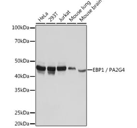 Western Blot - Anti-EBP1 Antibody [ARC1281] (A305749) - Antibodies.com