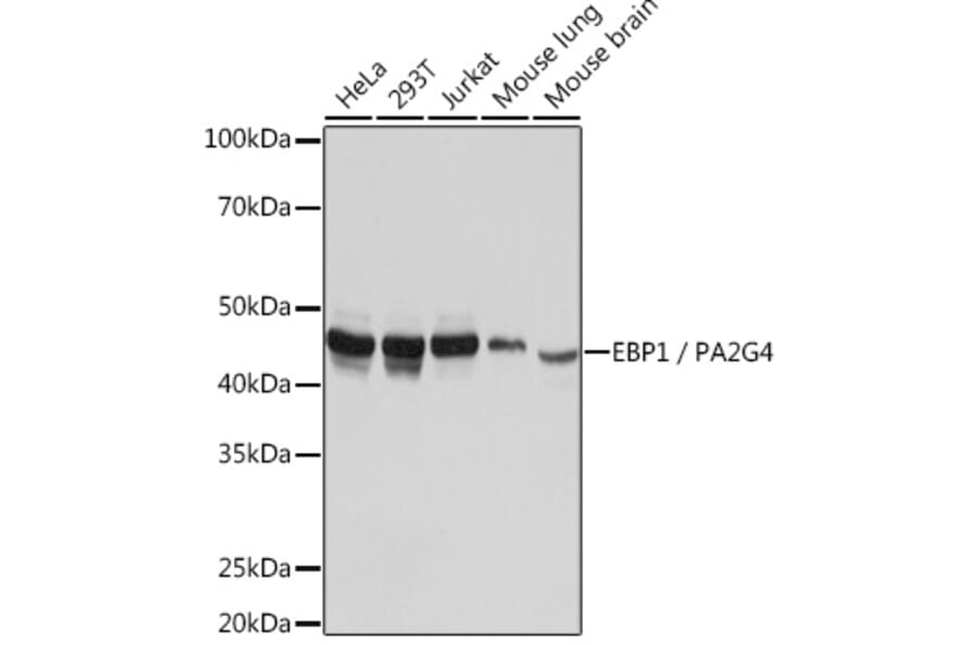 Western Blot - Anti-EBP1 Antibody [ARC1281] (A305749) - Antibodies.com