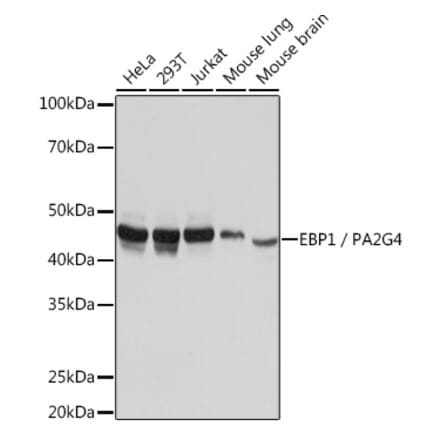 Western Blot - Anti-EBP1 Antibody [ARC1281] (A305749) - Antibodies.com