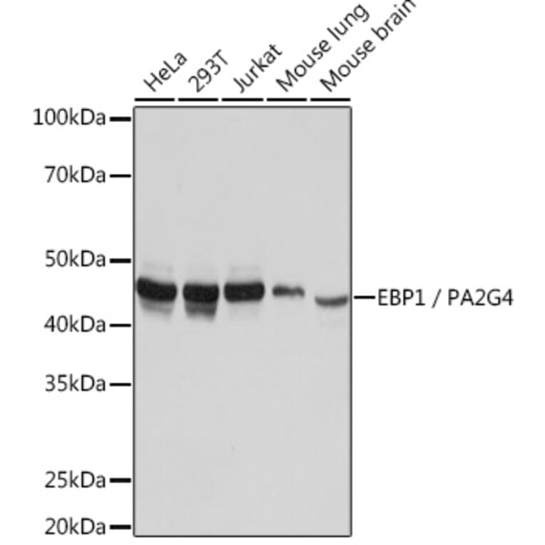 Western Blot - Anti-EBP1 Antibody [ARC1281] (A305749) - Antibodies.com