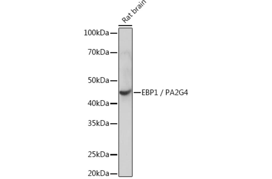 Western Blot - Anti-EBP1 Antibody [ARC1281] (A305749) - Antibodies.com