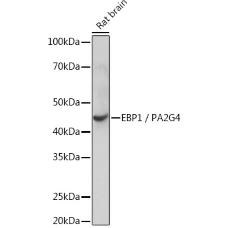 Western Blot - Anti-EBP1 Antibody [ARC1281] (A305749) - Antibodies.com