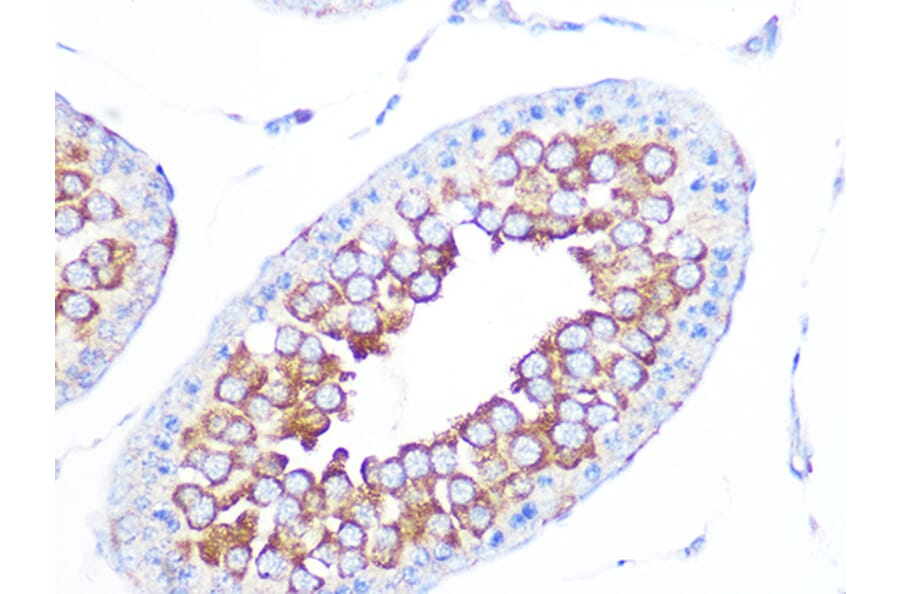 Immunohistochemistry - Anti-EBP1 Antibody [ARC1281] (A305749) - Antibodies.com