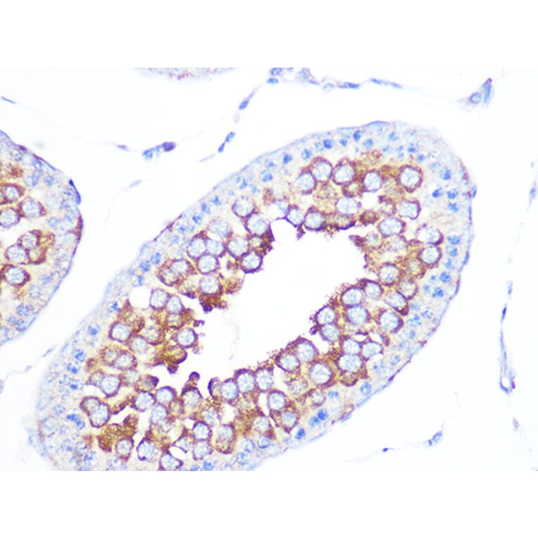 Immunohistochemistry - Anti-EBP1 Antibody [ARC1281] (A305749) - Antibodies.com