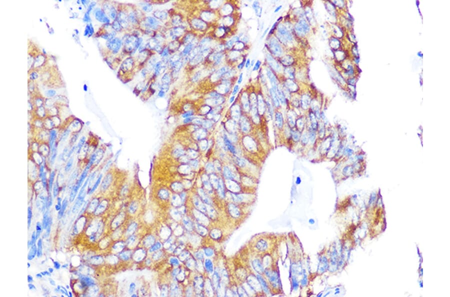 Immunohistochemistry - Anti-EBP1 Antibody [ARC1281] (A305749) - Antibodies.com