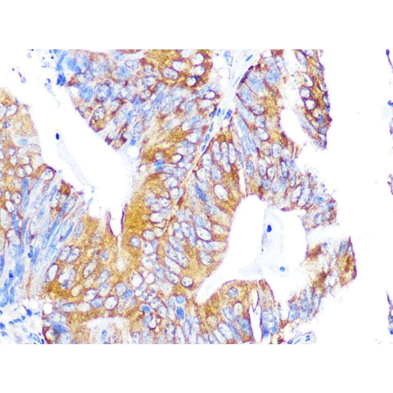 Immunohistochemistry - Anti-EBP1 Antibody [ARC1281] (A305749) - Antibodies.com