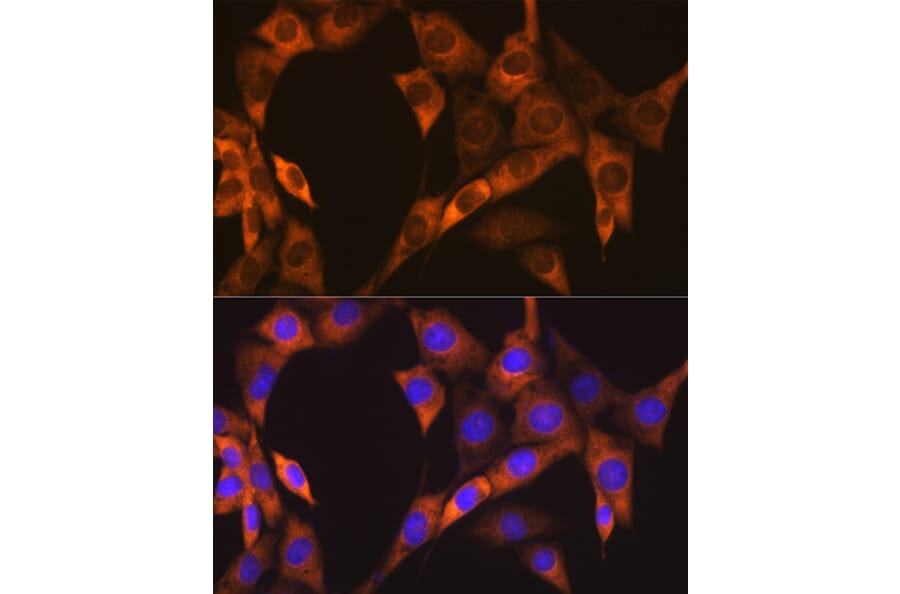 Immunofluorescence - Anti-EBP1 Antibody [ARC1281] (A305749) - Antibodies.com