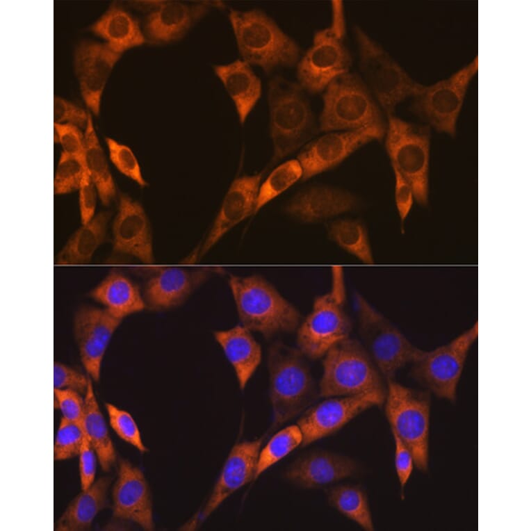 Immunofluorescence - Anti-EBP1 Antibody [ARC1281] (A305749) - Antibodies.com