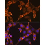 Immunofluorescence - Anti-EBP1 Antibody [ARC1281] (A305749) - Antibodies.com