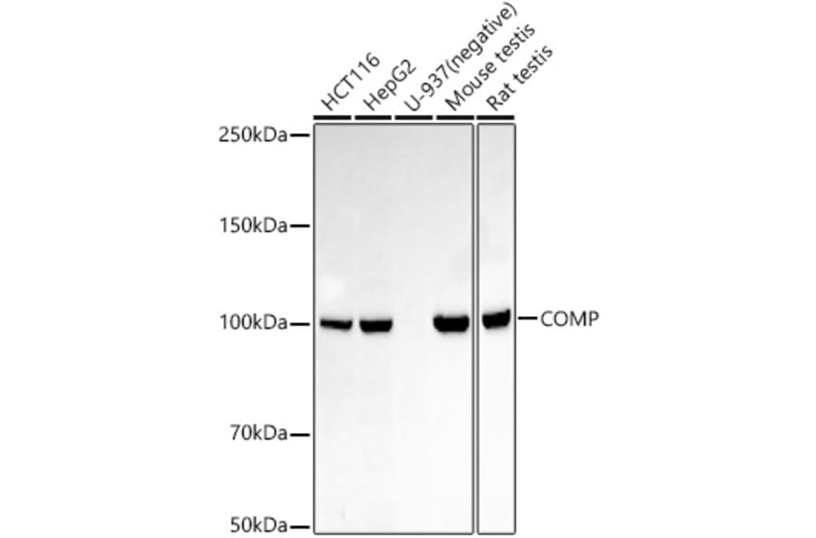 Western Blot - Anti-COMP/Cartilage oligomeric matrix protein Antibody (A305750) - Antibodies.com