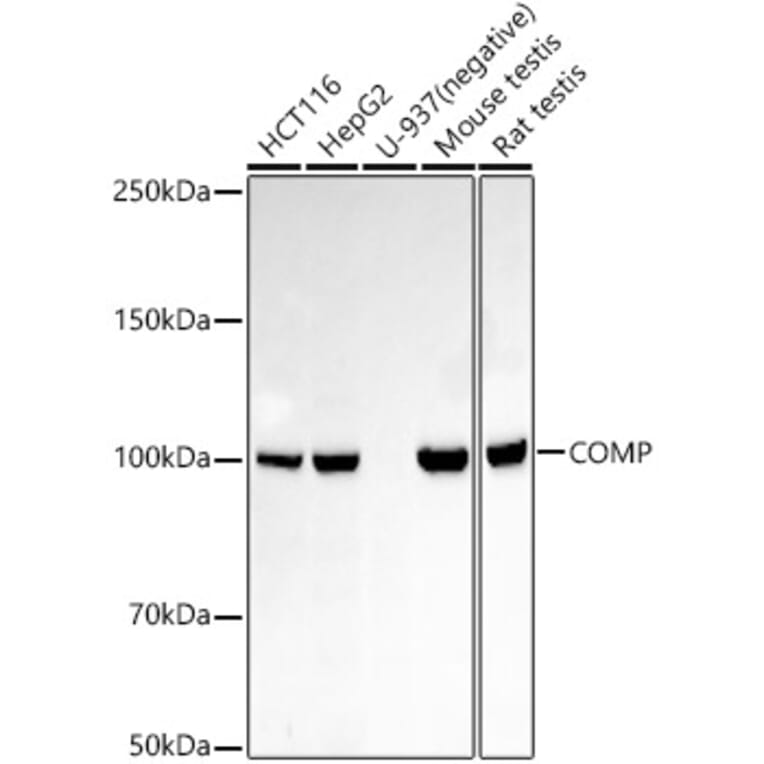 Western Blot - Anti-COMP/Cartilage oligomeric matrix protein Antibody (A305750) - Antibodies.com