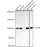 Western Blot - Anti-COMP/Cartilage oligomeric matrix protein Antibody (A305750) - Antibodies.com