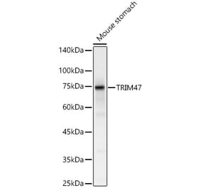 Western Blot - Anti-TRIM47 Antibody (A305751) - Antibodies.com