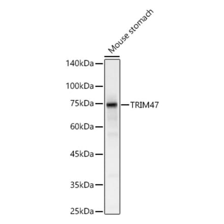 Western Blot - Anti-TRIM47 Antibody (A305751) - Antibodies.com