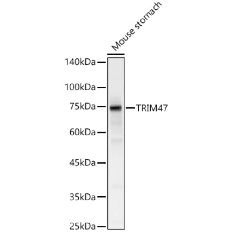 Western Blot - Anti-TRIM47 Antibody (A305751) - Antibodies.com