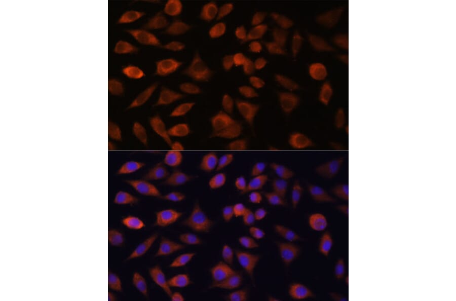 Immunofluorescence - Anti-TRIM47 Antibody (A305751) - Antibodies.com