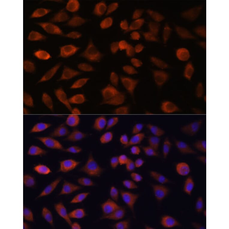 Immunofluorescence - Anti-TRIM47 Antibody (A305751) - Antibodies.com
