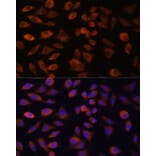 Immunofluorescence - Anti-TRIM47 Antibody (A305751) - Antibodies.com