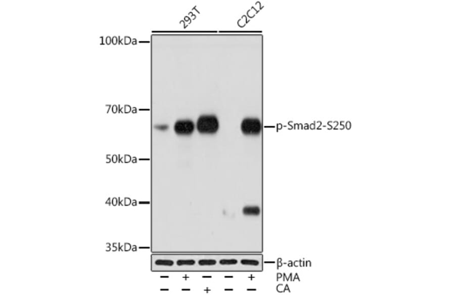 Western Blot - Anti-Smad2 (phospho Ser250) Antibody [ARC1552] (A305752) - Antibodies.com