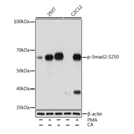 Western Blot - Anti-Smad2 (phospho Ser250) Antibody [ARC1552] (A305752) - Antibodies.com