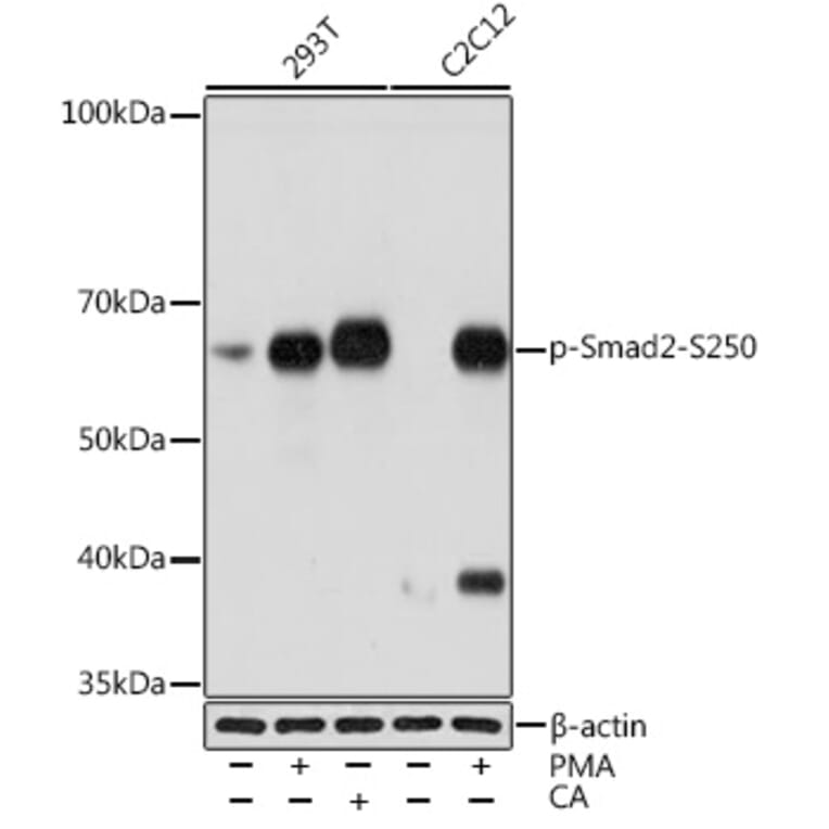 Western Blot - Anti-Smad2 (phospho Ser250) Antibody [ARC1552] (A305752) - Antibodies.com