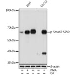 Western Blot - Anti-Smad2 (phospho Ser250) Antibody [ARC1552] (A305752) - Antibodies.com