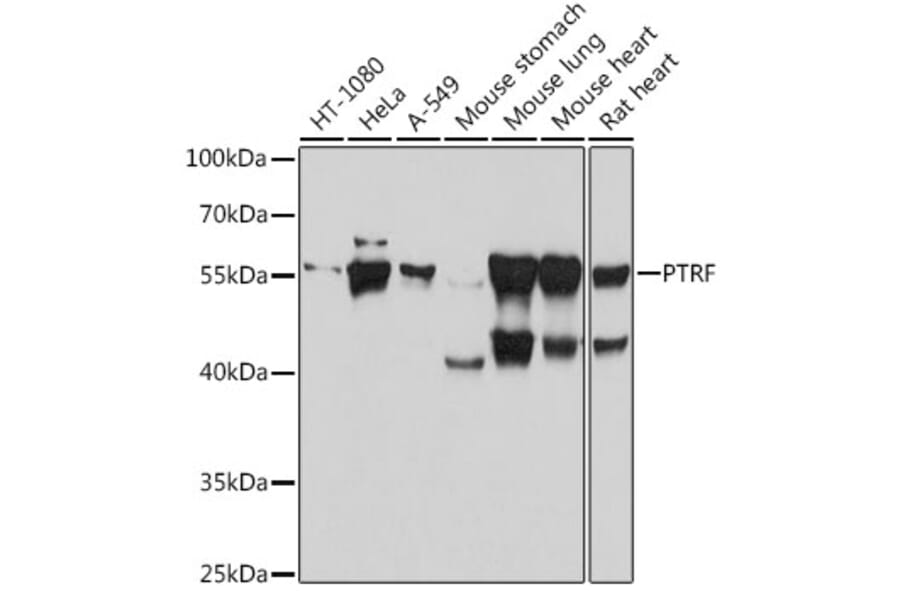 Western Blot - Anti-PTRF Antibody (A305754) - Antibodies.com