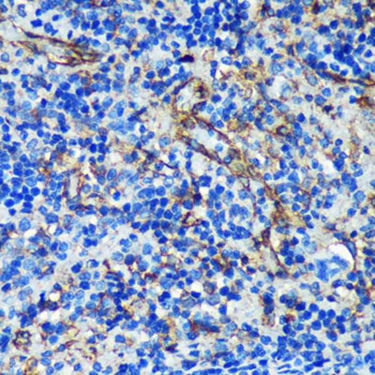 Immunohistochemistry - Anti-PTRF Antibody (A305754) - Antibodies.com