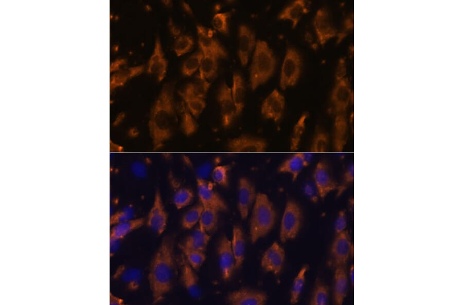 Immunofluorescence - Anti-PTRF Antibody (A305754) - Antibodies.com