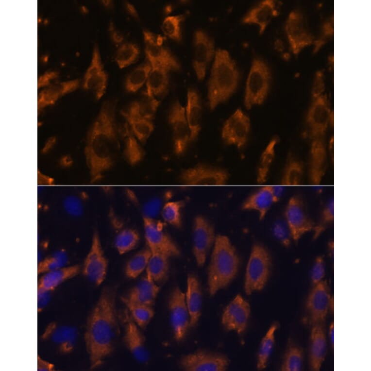 Immunofluorescence - Anti-PTRF Antibody (A305754) - Antibodies.com