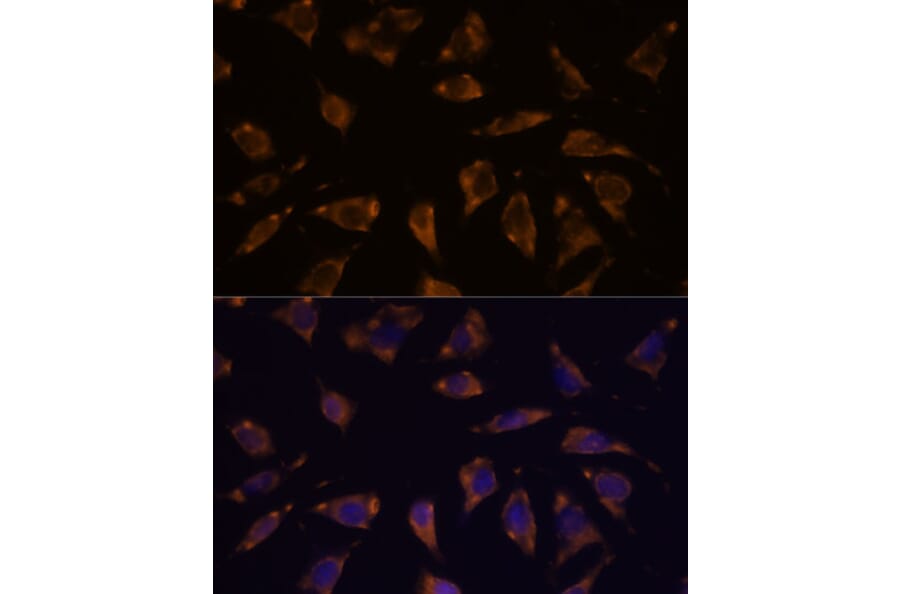Immunofluorescence - Anti-PTRF Antibody (A305754) - Antibodies.com