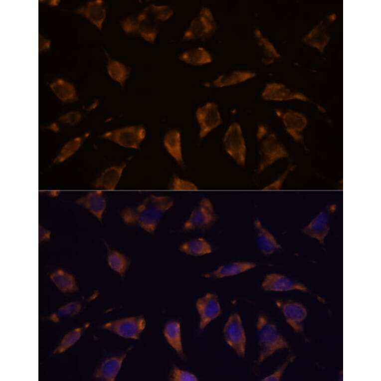 Immunofluorescence - Anti-PTRF Antibody (A305754) - Antibodies.com