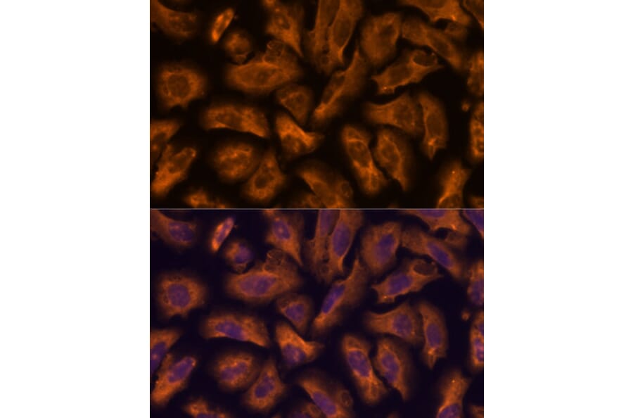 Immunofluorescence - Anti-PTRF Antibody (A305754) - Antibodies.com